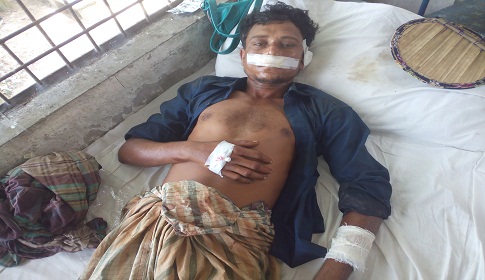 নগরকান্দায় ডাকাতের অস্ত্রের আঘাতে আহত ৩