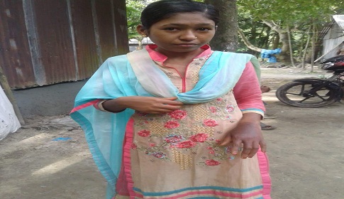 জামালপুরে যৌতুকের দাবিতে নববধূকে গরম তেল নিক্ষেপ
