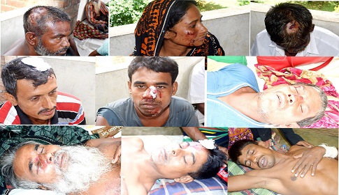 মহম্মদপুরে দুই দল গ্রামবাসীর সংঘর্ষ : নারীসহ আহত ৩০