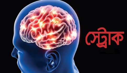 ব্রেন স্ট্রোক কেন হয়?