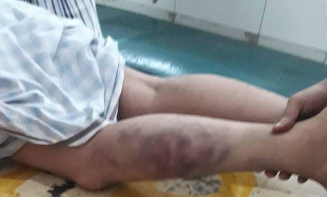 থানায় ঝুলিয়ে যুবককে নির্যাতন, চার পুলিশ বরখাস্ত