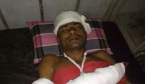 যুবলীগের সাংগঠনিক সম্পাদককে কুপিয়ে আহত করার অভিযোগ সভাপতির বিরুদ্ধে!