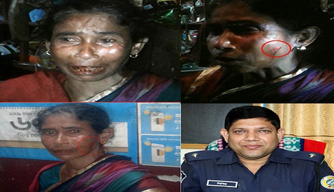 ডিআইজির কাছে বিচার চাওয়ায় ওসির হাতে বৃদ্ধা আহত, সিগারেটের ছ্যাকা