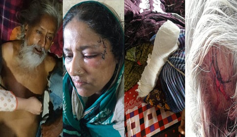 নোয়াখালীতে প্রতিপক্ষের হামলায় নারীসহ আহত ৫