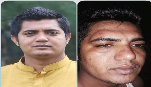 নোয়াখালী কোম্পানীগঞ্জে কলেজ ছাত্রলীগ সভাপতির ওপর হামলা