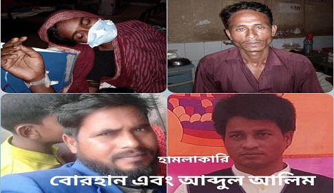 সুবর্ণচরে আন্তঃসত্ত্বা নারীকে পিটিয়ে আহত করলেন ইউপি মেম্বারের ছেলে