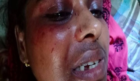 গলাচিপায় যৌতুকের দাবিতে গৃহবধূকে নির্যাতন
