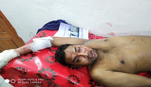 নড়াইলে প্রতিপক্ষের হামলায় পৌর কর্মচারীসহ আহত ২