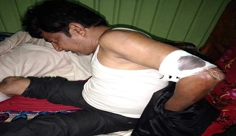 নোয়াখালীতে আ. লীগ সভাপতিকে কুপিয়ে জখম