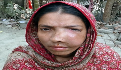 ক্যান্সার আক্রান্ত মনোয়ারা প্রধানমন্ত্রী ও দেশবাসীর সহযোগিতা চান
