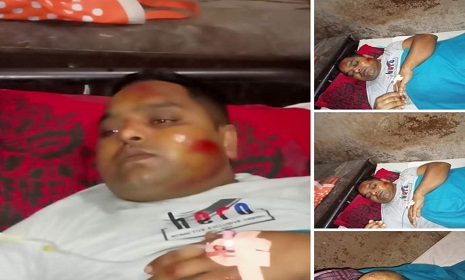 ঝিনাইদহে চেয়ারম্যান প্রার্থীর গাড়ির ধাক্কায় শিশুসহ আহত ৩
