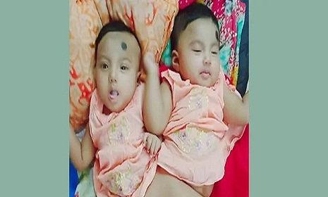 নুহা-নুবার চিকিৎসার দায়িত্ব নিলেন প্রধানমন্ত্রী