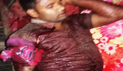 গৌরনদীতে একজনকে কুপিয়ে জখম