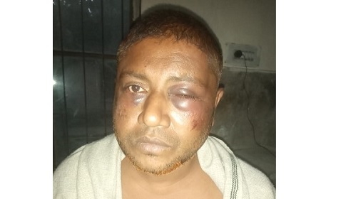 ব্যবসায়ীকে লোহার রড দিয়ে উপর্যুপরি পিটিয়ে হত্যার চেষ্টা