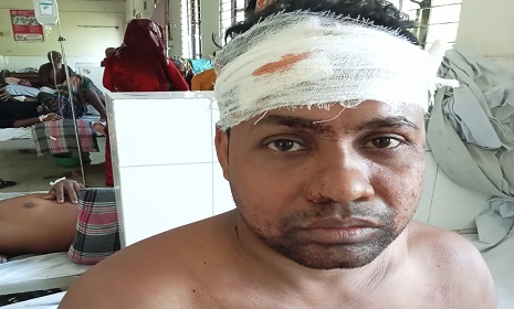 কালিগঞ্জে সজিনার ডাল কাটতে বাধা, আহত ২