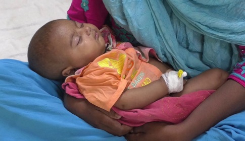 গোপালগঞ্জে ২৪ ঘণ্টায় হামে আক্রান্ত ২৭ রোগী হাসপাতালে 