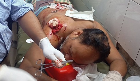 ঈদের নামাজে বক্তব্য দেওয়াকে কেন্দ্র করে বিএনপির দুই গ্রুপের সংঘর্ষ, পাল্টাপাল্টি মামলা 