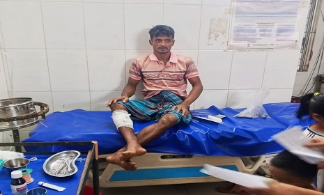 কাপ্তাইয়ে বন্য হাতির আক্রমণ, আহত দুই দিনমজুর, চিকিৎসা ব্যয় নিয়ে দুশ্চিন্তা 