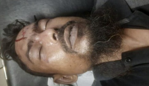 অণ্ডকোষ চেপে বাবাকে হত্যা, কিশোর ছেলে পুলিশ হেফাজতে