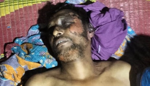 সাতক্ষীরায় ট্রান্সফর্মার চুরি করতে যেয়ে বিদ্যুৎস্পৃষ্ট হয়ে  চোরের মৃত্যু