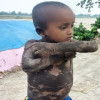 বিরল রোগে আক্রান্ত শিশু আকাশ