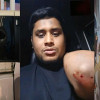 গাজীপুরে হাসনাত আব্দুল্লাহর গাড়িতে হামলা