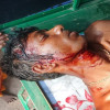 একই পরিবারের ১০ জনকে পিটিয়ে ও কুপিয়ে জখম