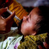 হামের উপসর্গে আরও ৬ শিশুর মৃত্যু