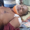 কানাইপুরের সেই দুই প্রতিপক্ষের মধ্যে আবারও সংঘর্ষ, আহত ৫