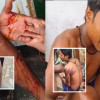 বঙ্গোপসাগরে দুই জেলে গ্রুপর মধ্যে সংঘর্ষ, আহত ৩