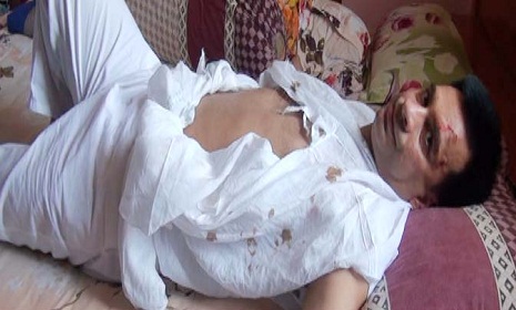 ফরিদপুরে উপজেলা চেয়ারম্যান লাঞ্ছিত