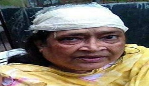 মৌলভীবাজারে বিএনপি নেত্রী আহত