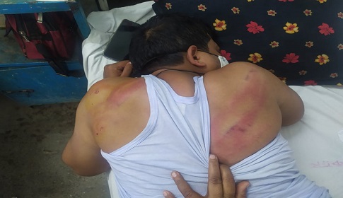 জুয়াড়িদের সংবাদ প্রকাশ করায় সাংবাদিককে মারপিট
