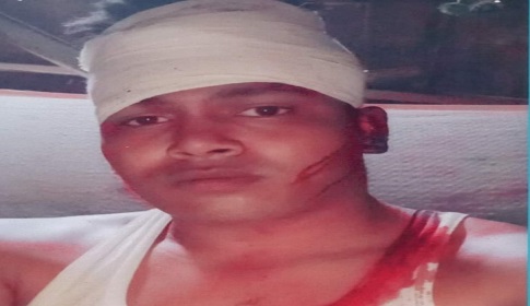 জুয়া খেলায় বাধা দেওয়ায় দুইজনকে কুপিয়ে জখম