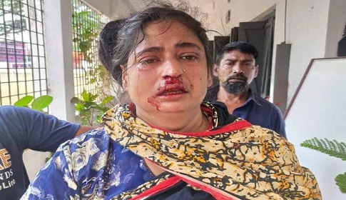 জেলা প্রশাসক দপ্তরের কর্মচারীর কিল-ঘুষিতে স্কুলের আয়া রক্তাক্ত