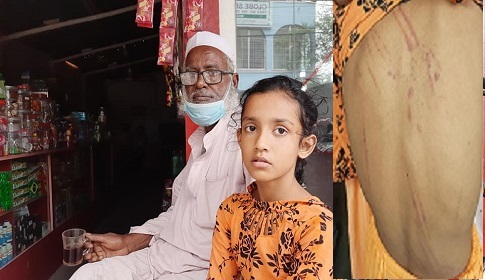 পড়া না পারায় মাদ্রাসার ছাত্রীকে পিটিয়ে আহত করলো শিক্ষক