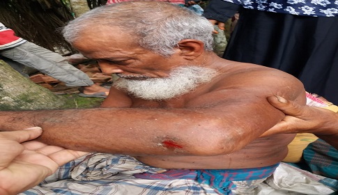 রায়পুরে বৃদ্ধকে পিটিয়ে জখম করলেন নাতি ও পুত্রবধূরা