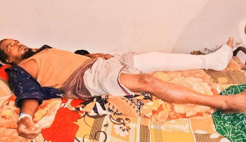নৌকা প্রার্থীর কর্মীরা পিটিয়ে ভেঙে দিল স্বতন্ত্র প্রার্থীর সমর্থকের ‘পা’!