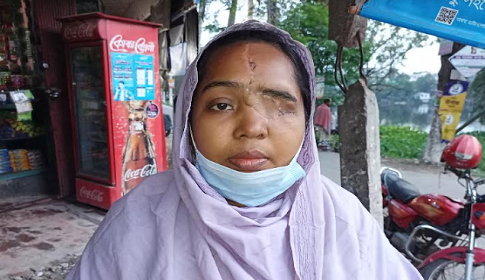 ডাক্তারের ভুল চিকিৎসায় চোখ হারালেন শাহিনুর!