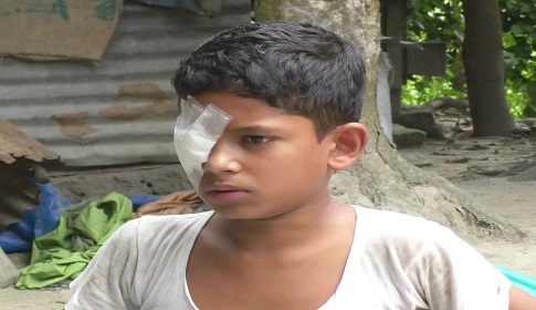 গোপালগঞ্জে বাজি ফোটানোর সময় দুই শিক্ষার্থী আহত