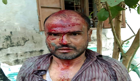 বাউফলে জমির বিরোধে দিনমজুরকে কুপিয়ে হত্যার চেষ্টা