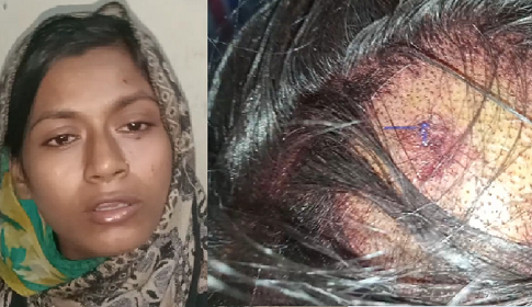 ভোলার তজুমদ্দিনে গৃহবধূকে মধ্যযুগীয় কায়দায় নির্যাতন