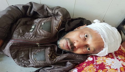 কালিগঞ্জে জমি আত্মসাতের লক্ষ্যে মানসিক প্রতিবন্ধীকে কুপিয়ে জখম, গ্রেপ্তার ১