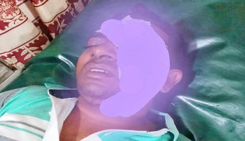 মহম্মদপুরে শ্যালকের ধারালো অস্ত্রের কোপে আহত দুলাভাই