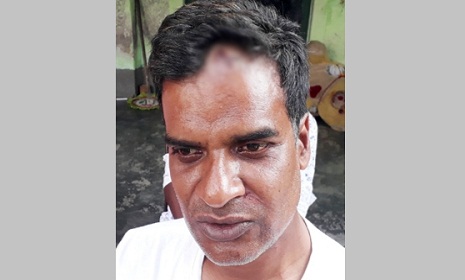 দিনাজপুর স্বেচ্ছাসেবক লীগের আহবায়কের বাড়িতে দুর্ধর্ষ ডাকাতি, মেরে ফেলার হুমকি