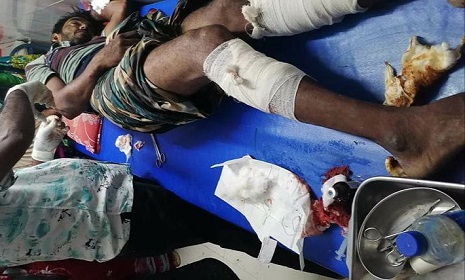 বোয়ালমারীতে শ্রমিক লীগ কর্মীকে কুপিয়ে জখম