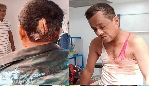 বিএনপির রোড মার্চে যাওয়ার পথে হামলায় ৭ জন আহত