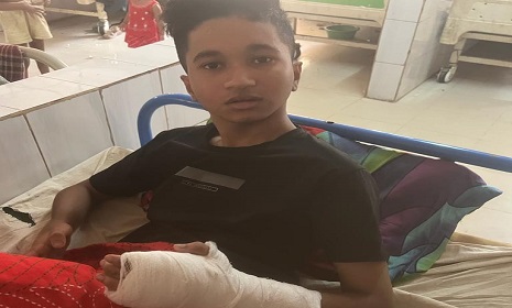রাজৈরে স্কুল ছাত্রকে পিটিয়ে হাত ভেঙ্গে দিলো সহপাঠি ও সন্ত্রাসীরা