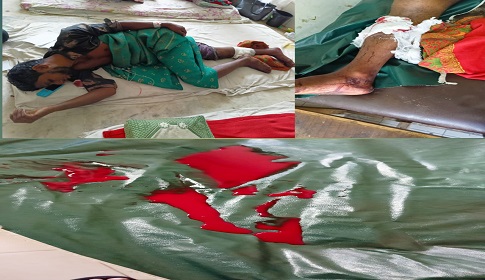 বালিয়াকান্দিতে ঘরের দরজা ভেঙ্গে ৩ জনকে কুপিয়ে ও পিটিয়ে স্বর্ণালংকার-টাকা লুট, আটক ২