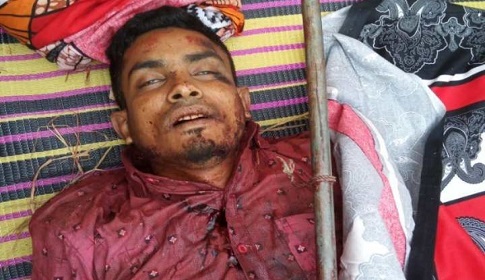 মধুপুরে অটোরিকশার সঙ্গে সংঘর্ষে মোটরসাইকেল আরোহী নিহত